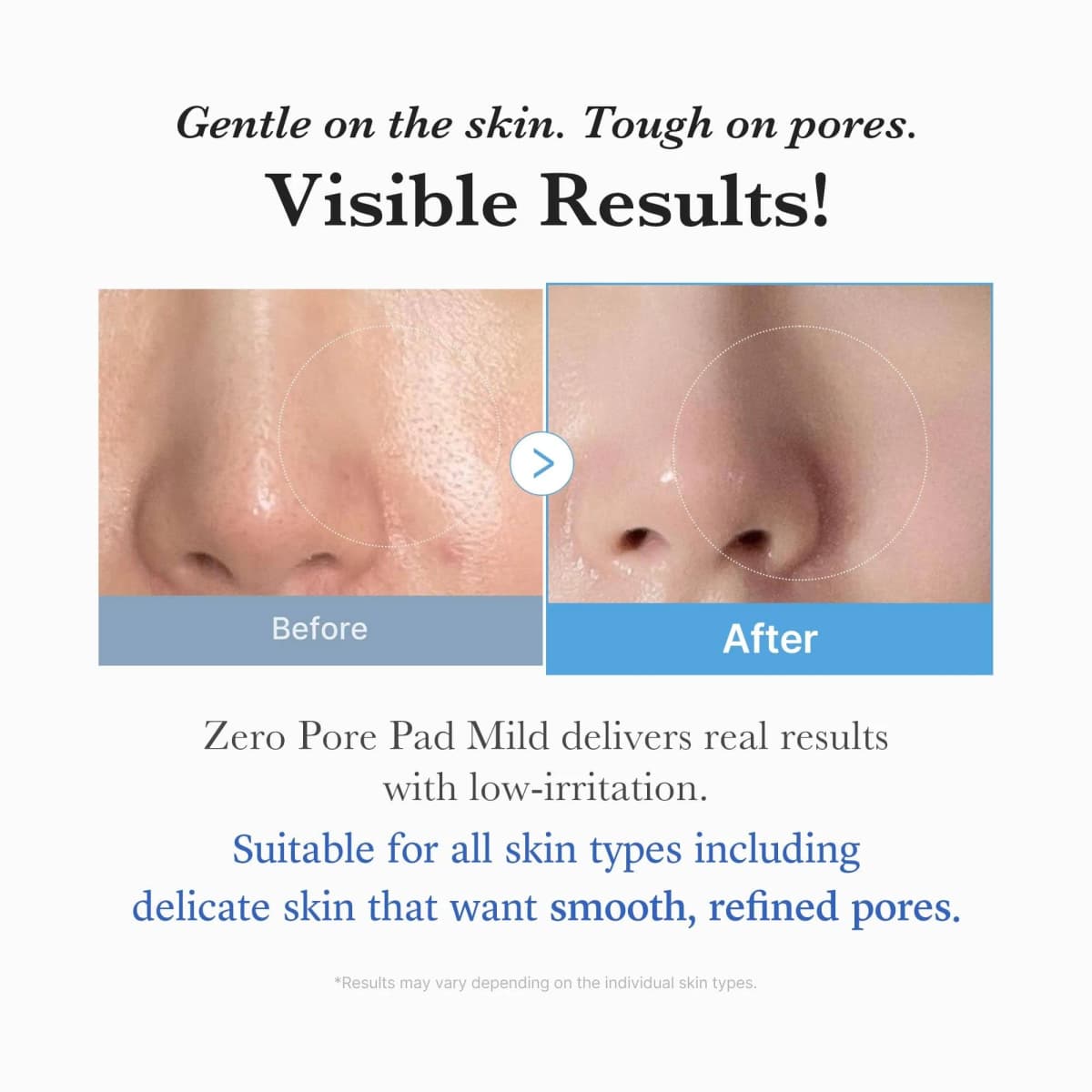 zero pore pad mild2